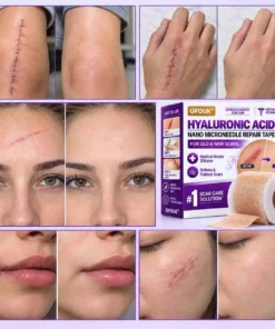 GFOUK® Medical-Grade Nano Microneedle Scar Repair Tape