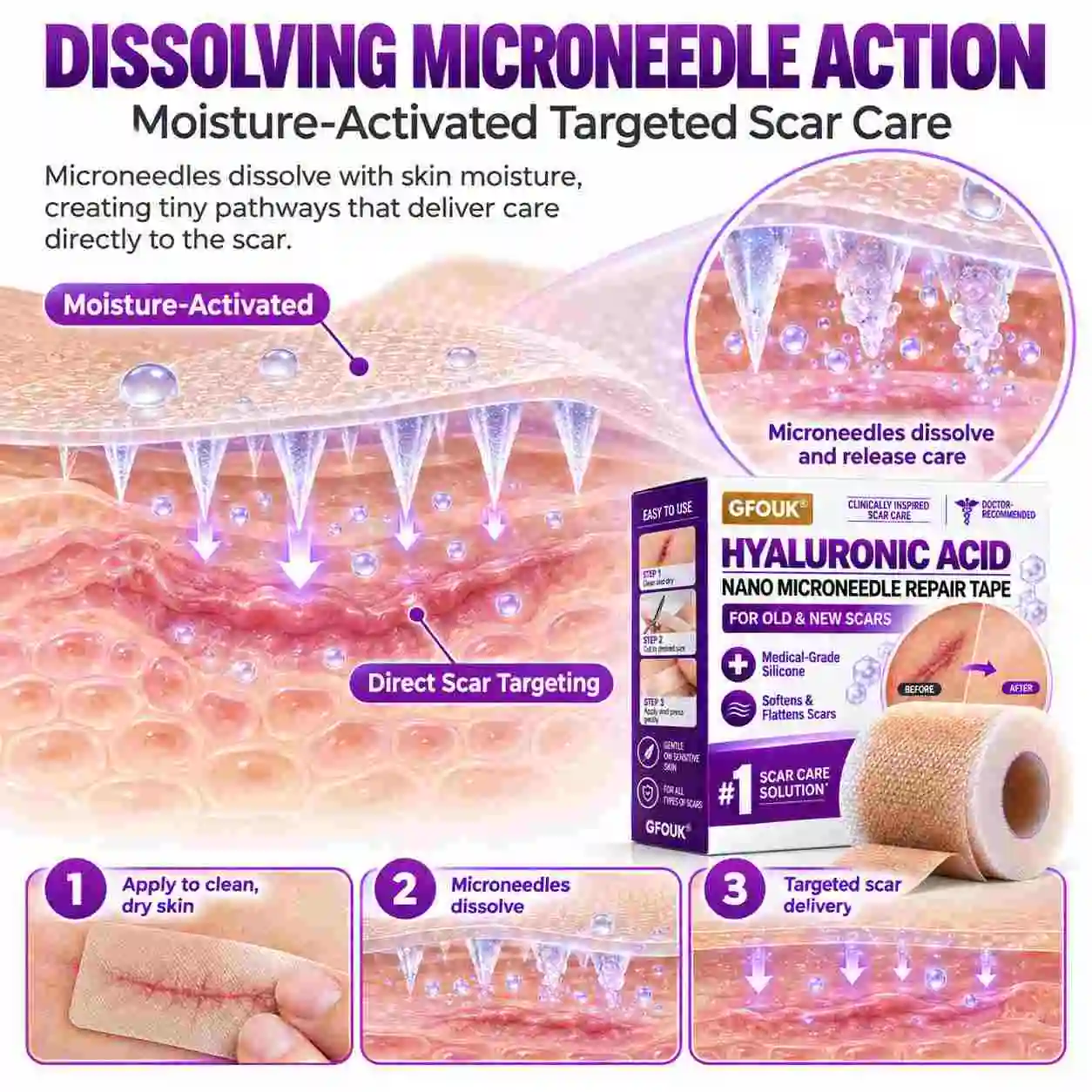 GFOUK® Medical-Grade Nano Microneedle Scar Repair Tape