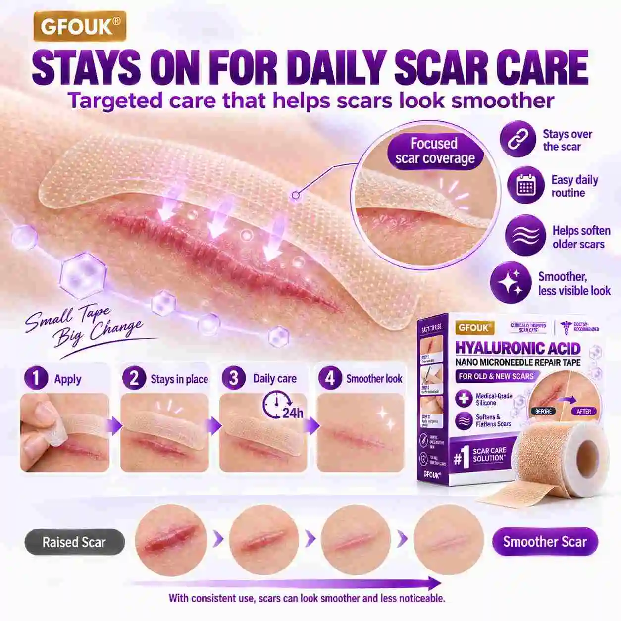 GFOUK® Medical-Grade Nano Microneedle Scar Repair Tape