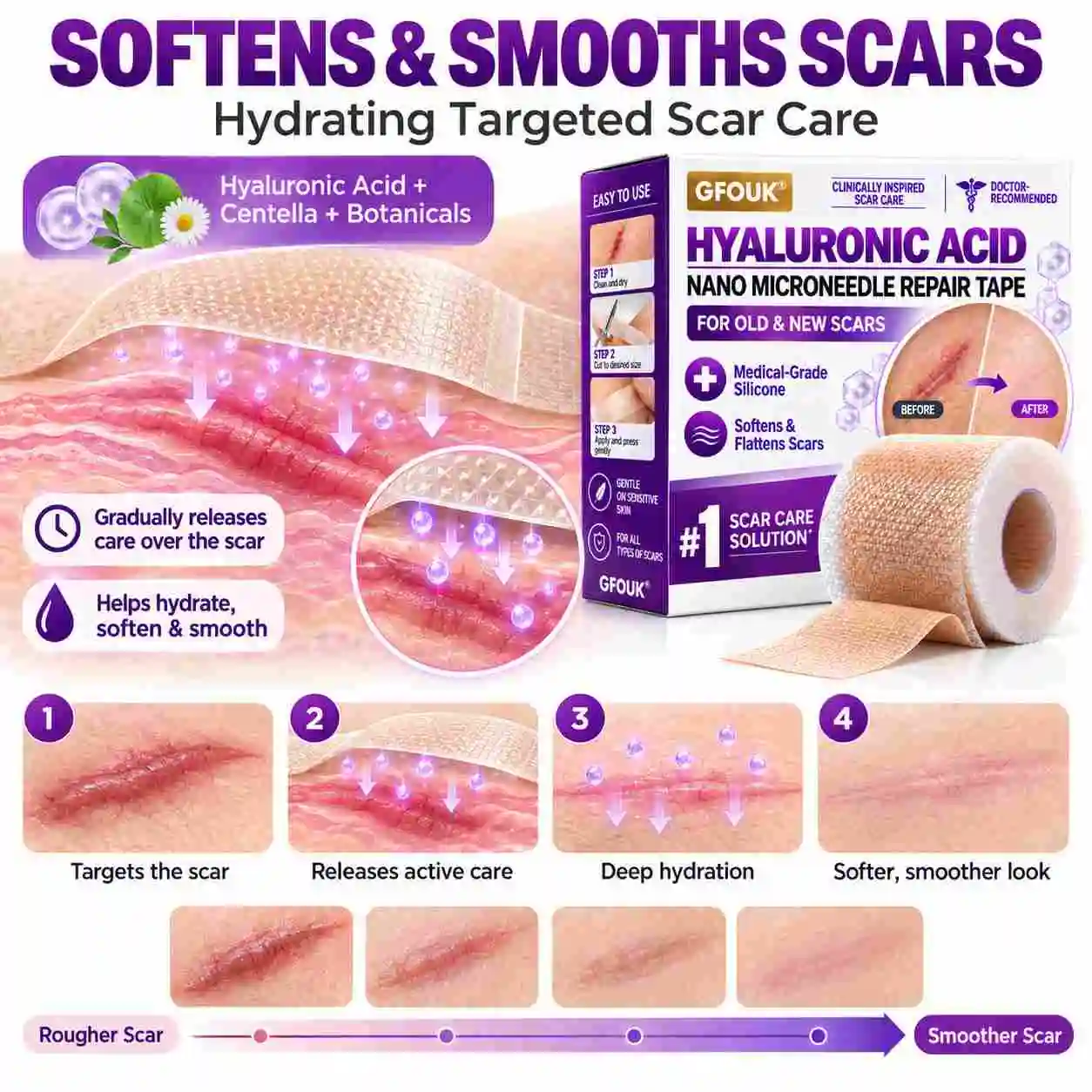 GFOUK® Medical-Grade Nano Microneedle Scar Repair Tape
