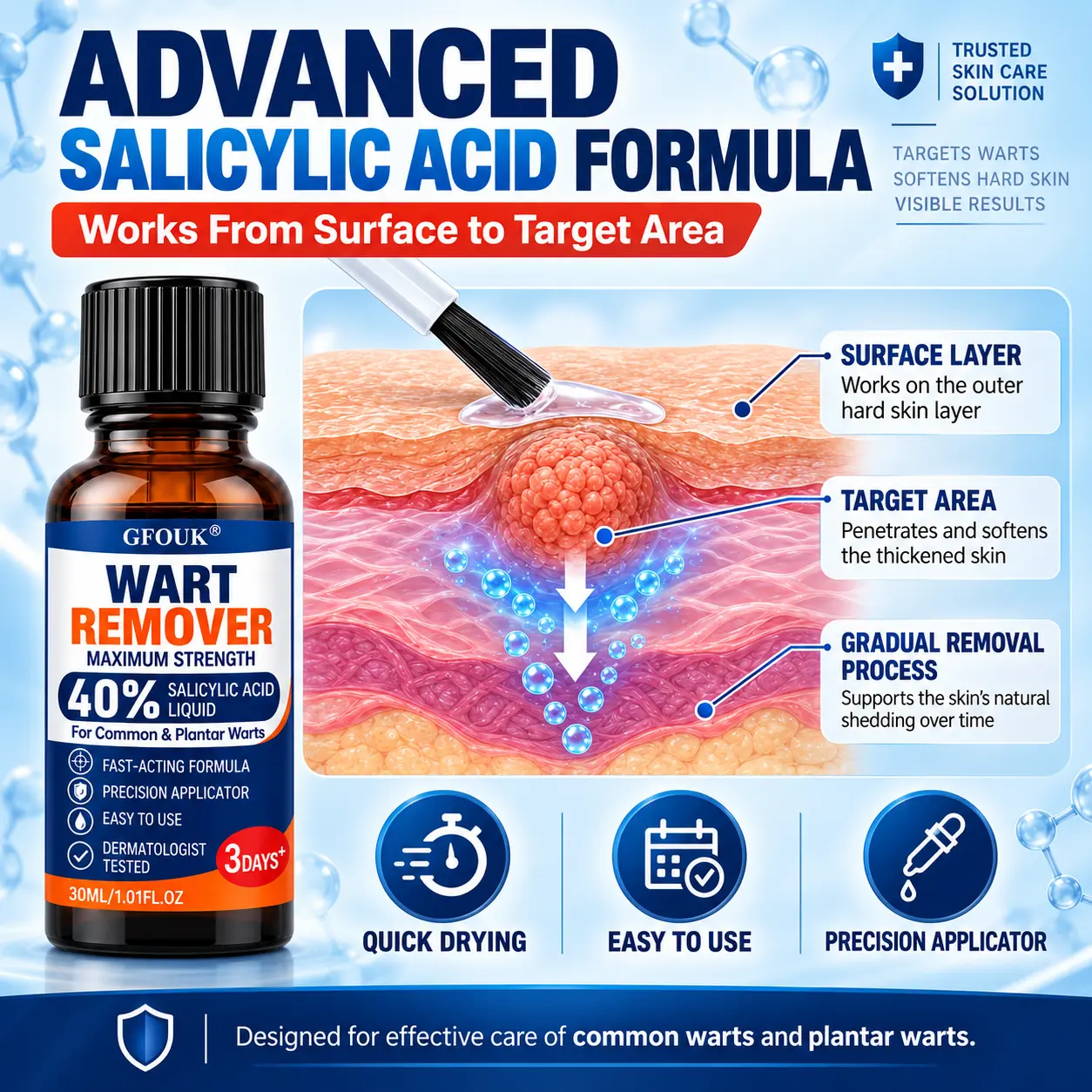 GFOUK®40% Salicylic Acid Wart Remover Liquid