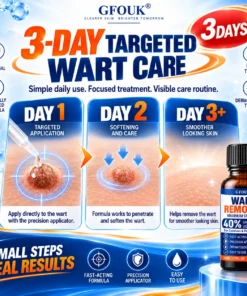 GFOUK®40% Salicylic Acid Wart Remover Liquid