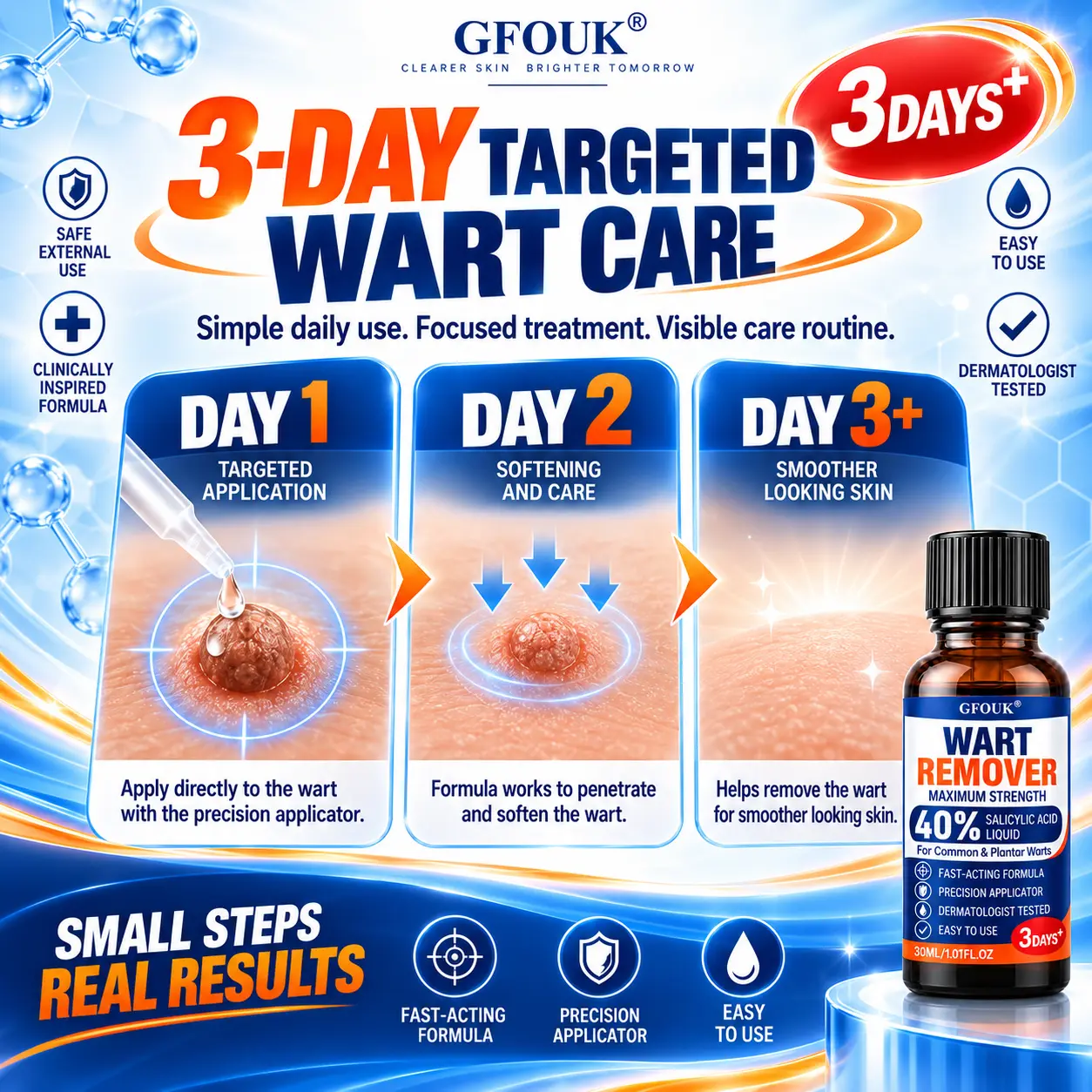 GFOUK®40% Salicylic Acid Wart Remover Liquid