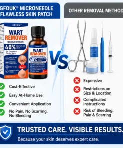 GFOUK®40% Salicylic Acid Wart Remover Liquid